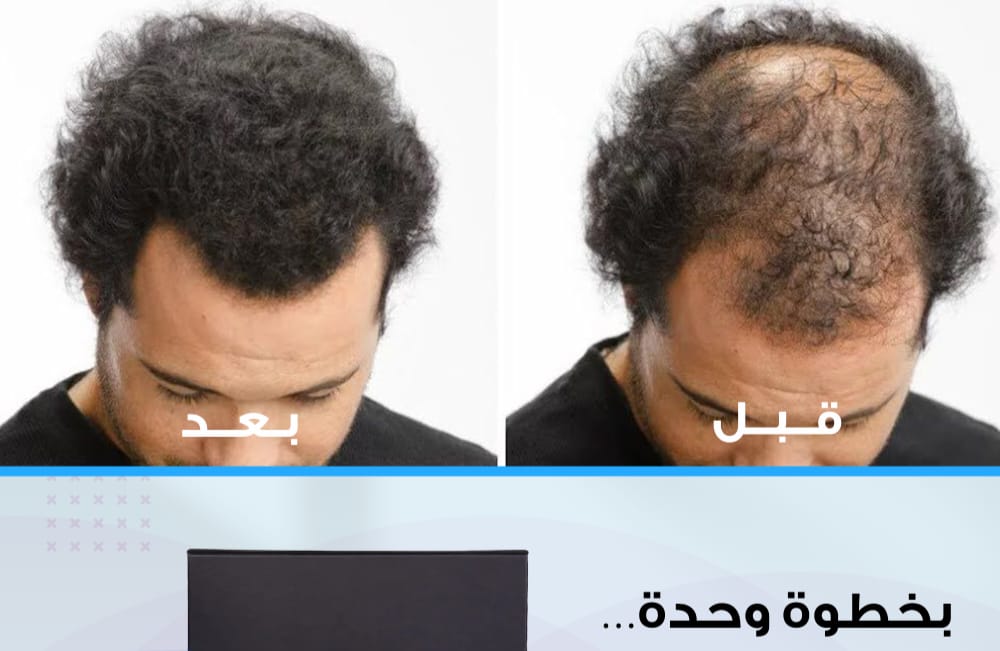 Aftabi hair serum