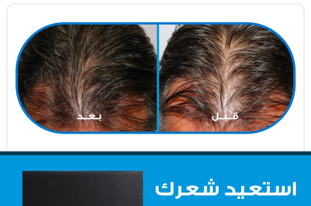 Aftabi hair serum